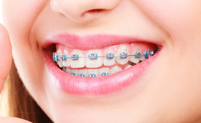 Orthodontics